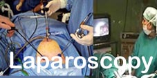 laparoscopic Surgery